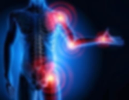 Abgebildet ist ein menschlicher Körper. Bereiche wie Hüfte, Schulter, Ellenbogen und Handgelenk sind mit roten Kreisen markiert