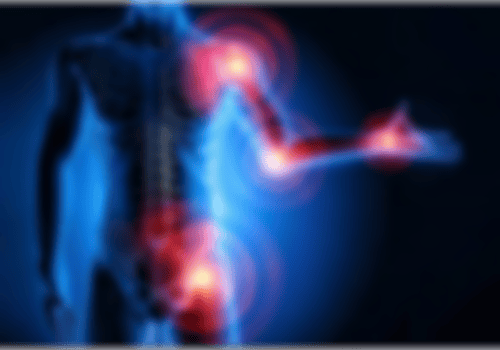 Röntgenbild eines Menschen mit Schmerzpunkten