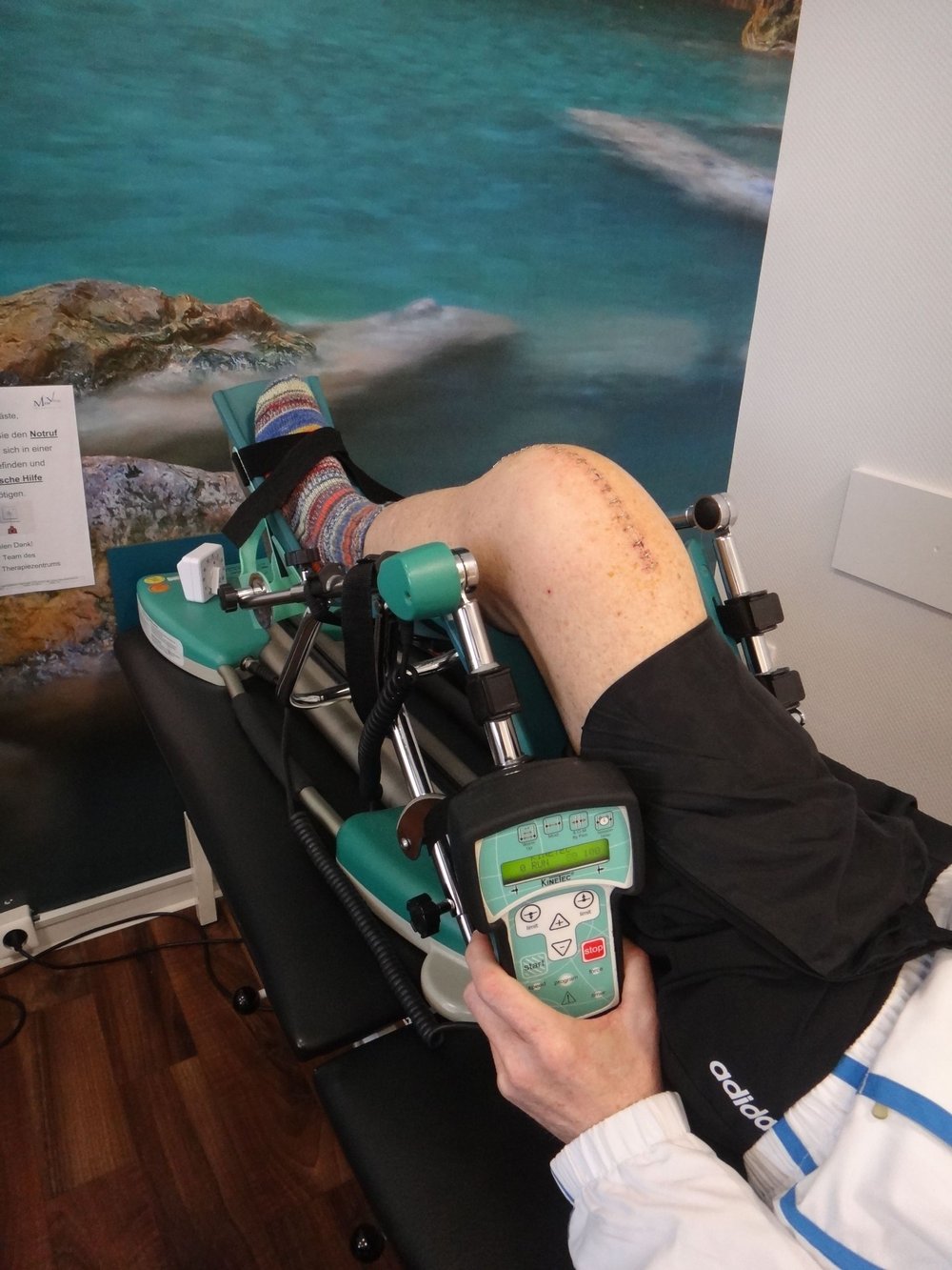 Mann mit Arthrofibrose wird am Bein behandelt mit Motorschiene