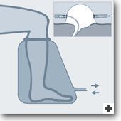 Wirkungsweise Ozontherapie in der Heilpraktiker Praxis Münster von Iris Kreuzheck-Koch