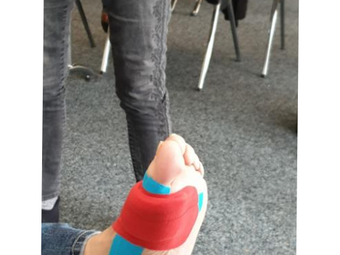 Fuß-Taping in der podologischen Praxis Münster