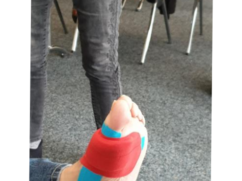 Fuß-Taping in der podologischen Praxis Münster