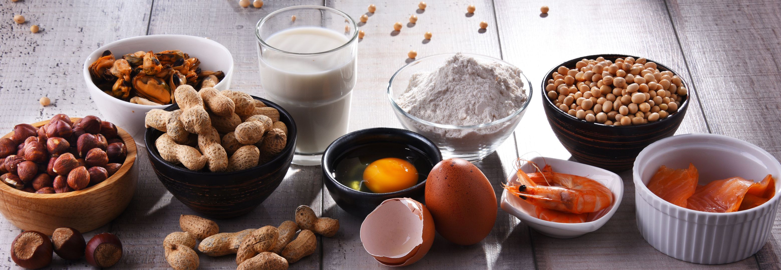 Allergene und Zusatzstoffe kennzeichnen lassen - Gastroexperten