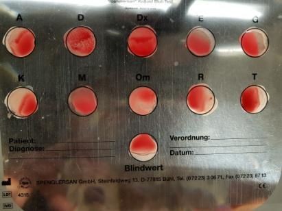 Spenglersan Therapie in der Heilpraktiker Praxis Münster von Iris Kreuzheck-Koch