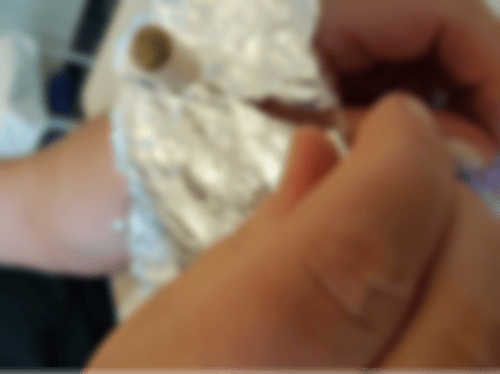 Ohrakupunktur-Therapie in der Heilpraktiker Praxis Münster von Iris Kreuzheck-Koch