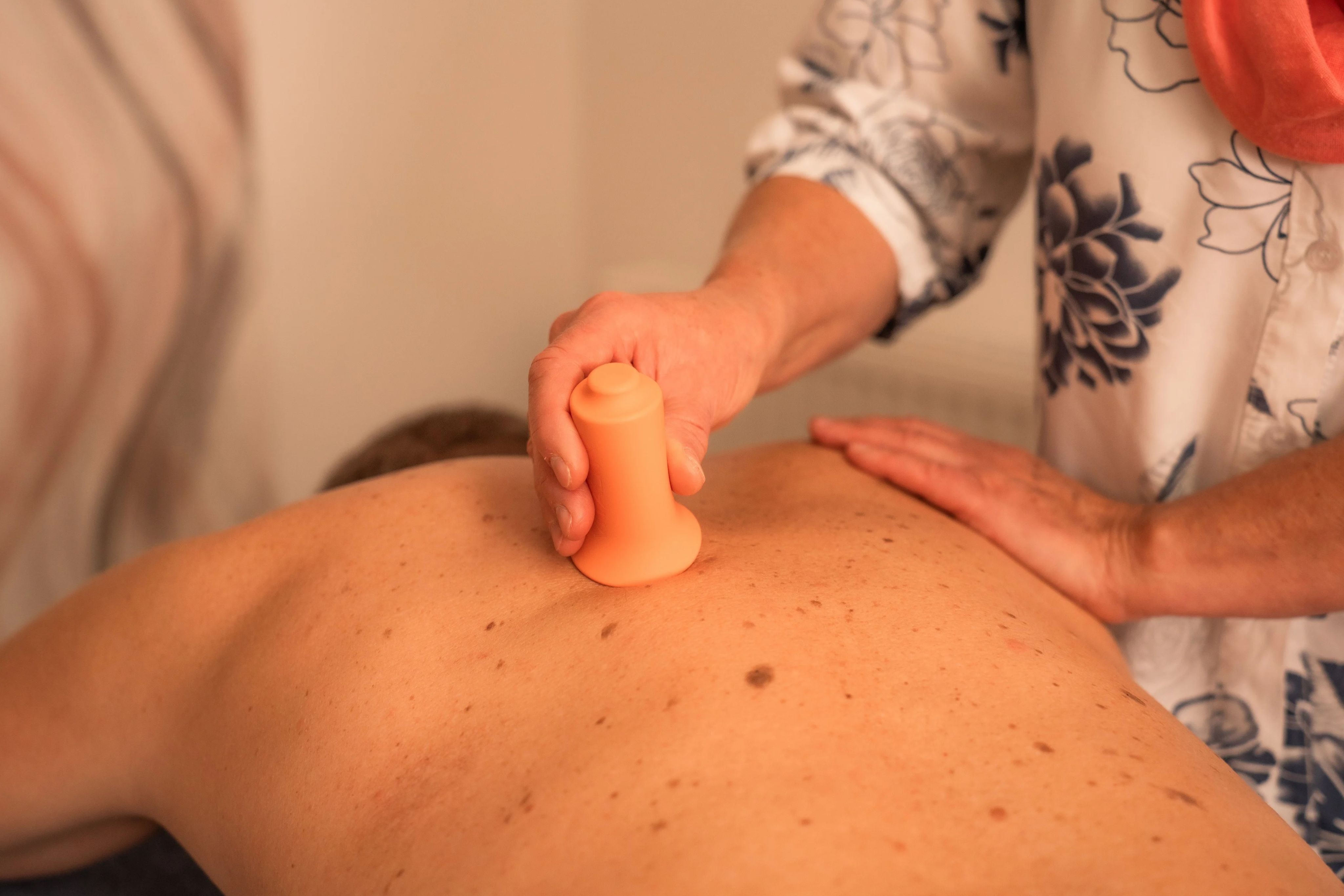 Wilma Kreß beim Schröpfen